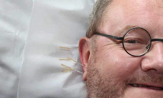 Les orelles són una part del cos que es fa servir molt en acupuntura